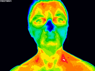 Thermal Imaging